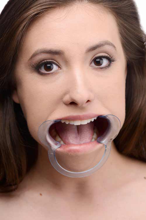 Cheek+Retractor+Dental+Open+Mouth+Gag